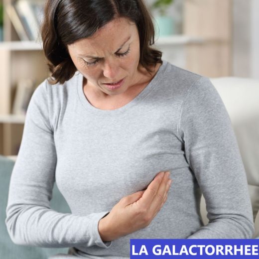 la galactorrhée
