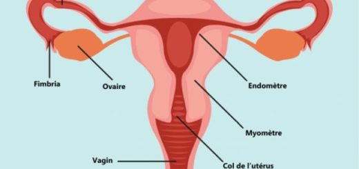 Salpingite Ovarite Annexite Trompes Bouchées Traitement Efficace