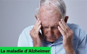 alzheimer