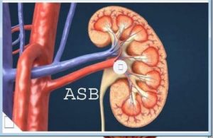 Tisane Pour Soigner Insuffisance Rénale Naturellement