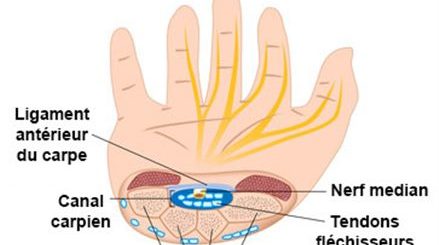 canal carpien traitement naturel
