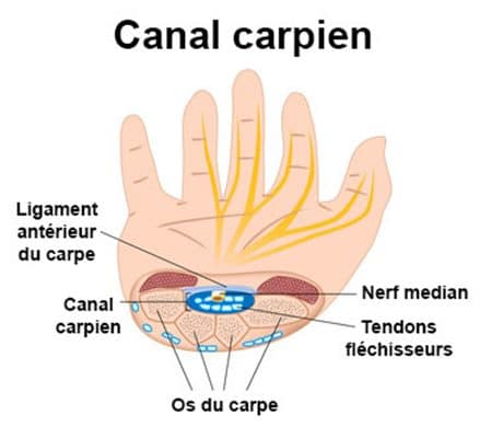 canal carpien traitement naturel