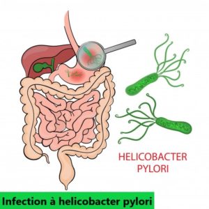 helicobacter pylori