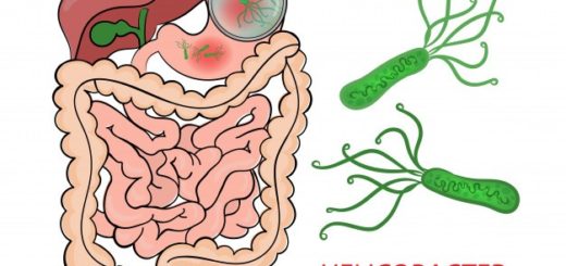 helicobacter pylori