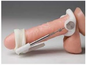 Extenseur pour Agrandir Pénis Pour Grossir le Pénis