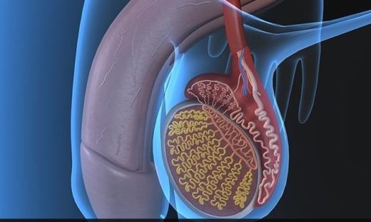 Varicocèle Chirurgie ou Traitement Naturel