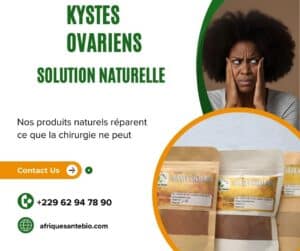 Kystes ovariens 