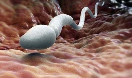 Comment traiter le manque de spermatozoïde
