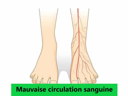 mauvaise circulation sanguine traitement naturel, remède grand-mère bio