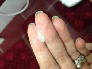 absence de perte blanche traitement naturel.