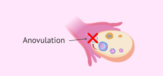 ovulation et grossesse traitement naturel, probleme d'ovulation,