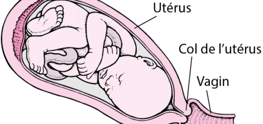 cancer du col de l'utérus et grossesse