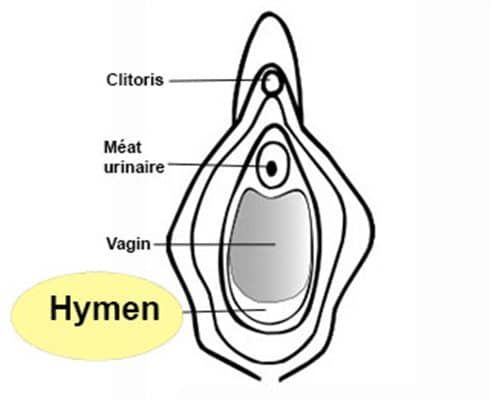 reconstruction de l'hymen sans chirurgie