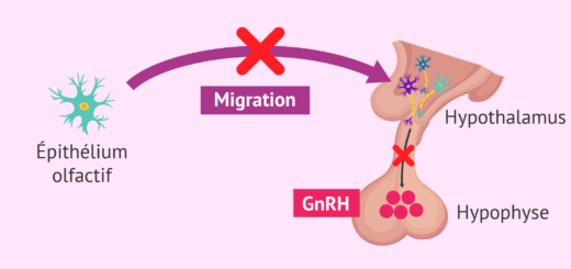 syndrome de kallmann korsier traitement naturel, fertilité, grossesse