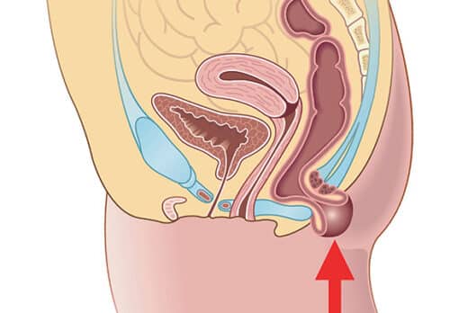 Quand je me met un doigt je sens une boule