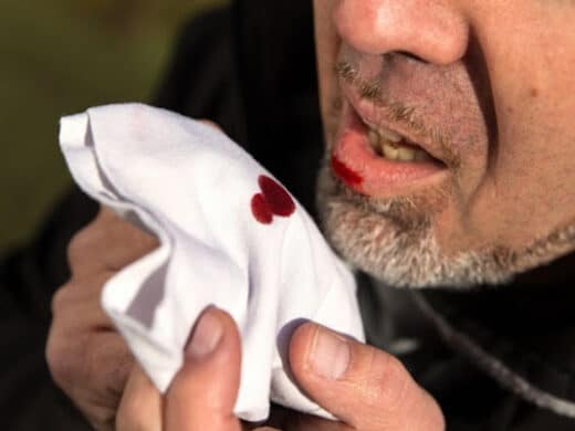 Hémoptysie traitement naturel