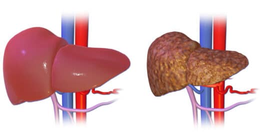 Nouveau traitement hépatite B 2023