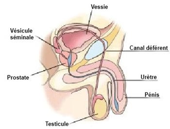 Résection transurétrale de la prostate