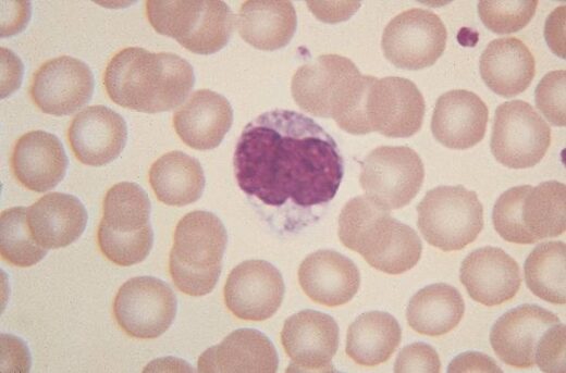 Monocytes élevés traitement naturel