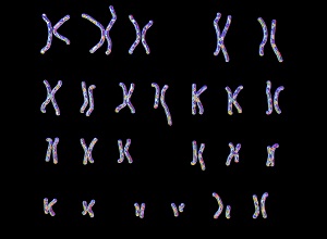 Caryotype infertilité traitement naturel
