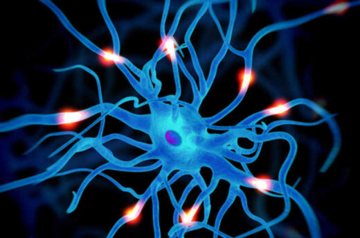 Symptômes sclérose en plaque