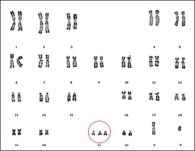 Cellule germinale homme et spermatozoides