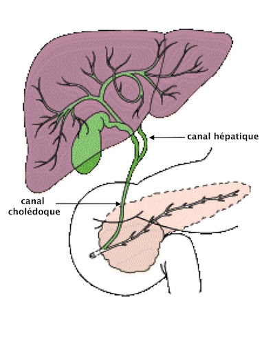 Cholestase hépatique traitement naturel