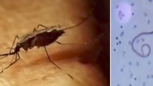 Filariose lymphatique traitement naturel