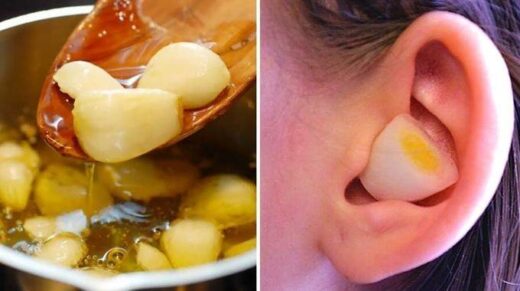 Astuces naturelles pour soulager les maux d'oreilles