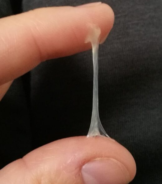 Remède efficace contre les pertes blanches