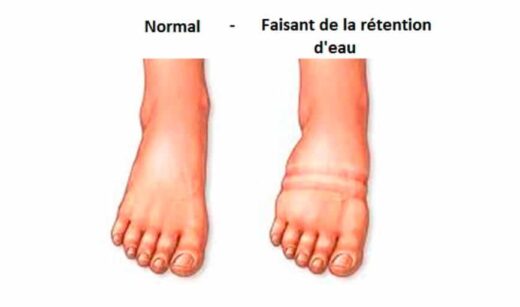 éliminer 10 kg de rétention d'eau