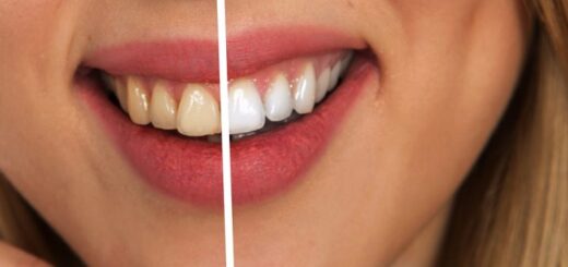 Astuces pour avoir les dents blanches