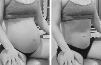 Ventre gonflé et dur