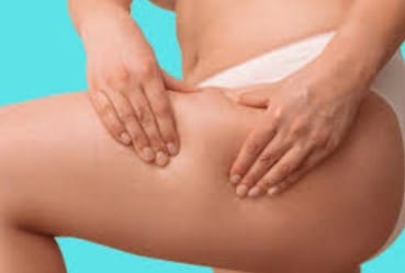 Comment maigrir des cuisses