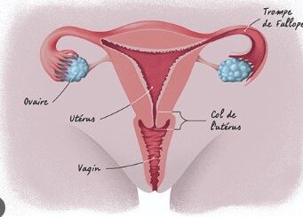 petits ovaires conséquences