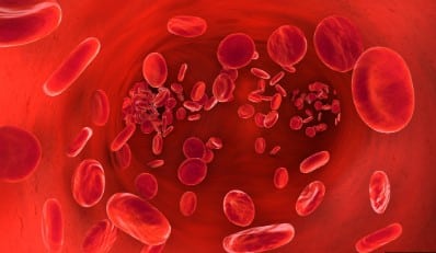 Remède de grand-mère pour nettoyer le cœur