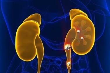 Définition anurie traitement naturel