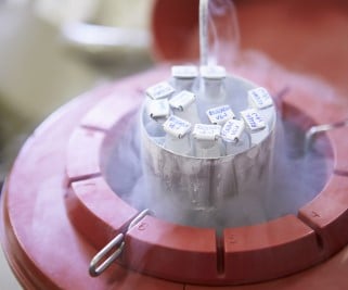 Congélation et conservation du sperme