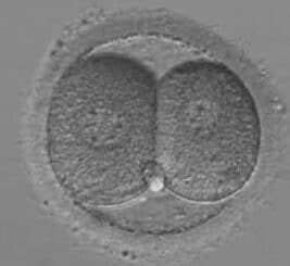 Embryon blastocyste b4aa qualité