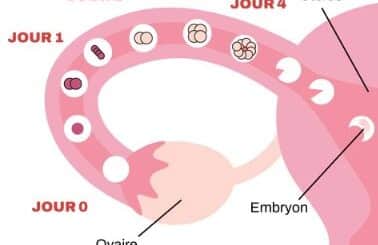 Symptôme ovulation