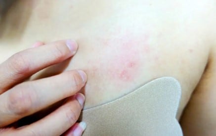 Pourquoi mes tétons me grattent