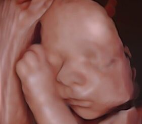 échographie 3D bébé