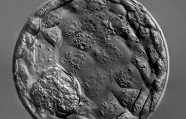 Classification blastocyste