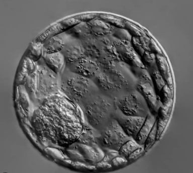 Classification blastocyste