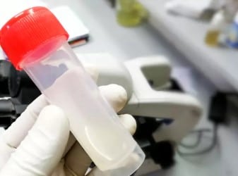 Abstinence spermogramme