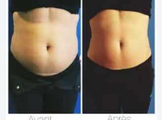 silhouette affinée grâce à une cure minceur naturelle