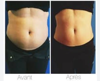 silhouette affinée grâce à une cure minceur naturelle