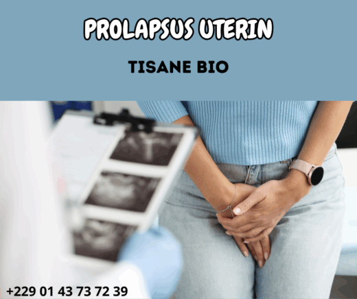 Existe-t-il un traitement naturel pour le prolapsus utérin ?