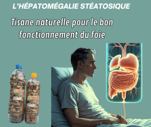 Hépatomégalie stéatosique causes symptômes