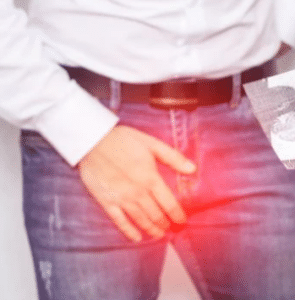 Varicocèle Testiculaire: définition causes et traitements